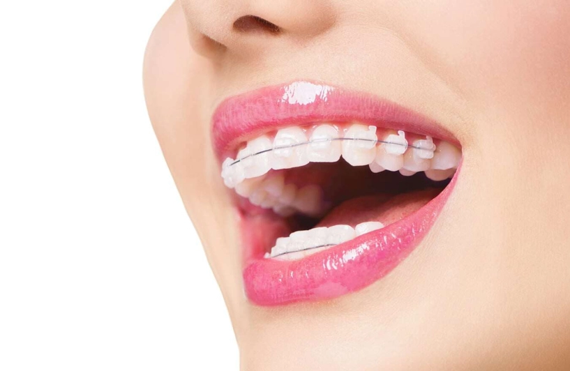 Phương pháp làm đẹp được công khai ở các cuộc thi nhan sắc hầu như ai ứng dụng cũng đều đăng quang - 1