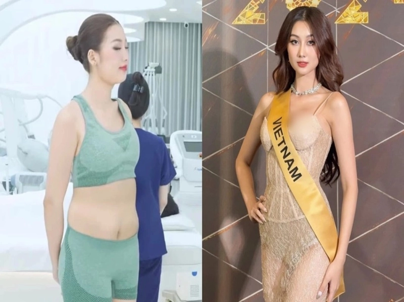 Quế anh nói gì khi bị cắt ghép ảnh đi hút mỡ bụng - 1