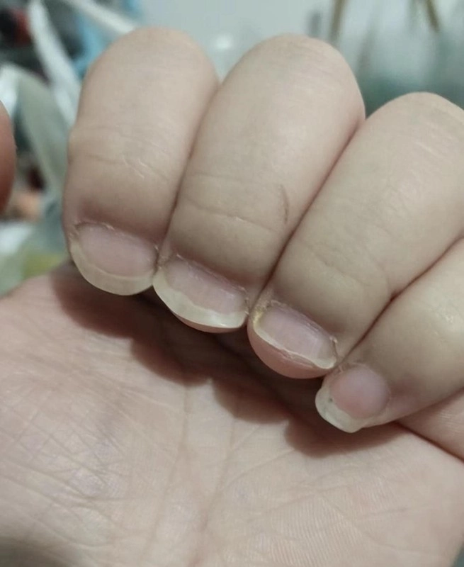 sang chấn tâm lý với những mẫu nail tết độc lạ - 10