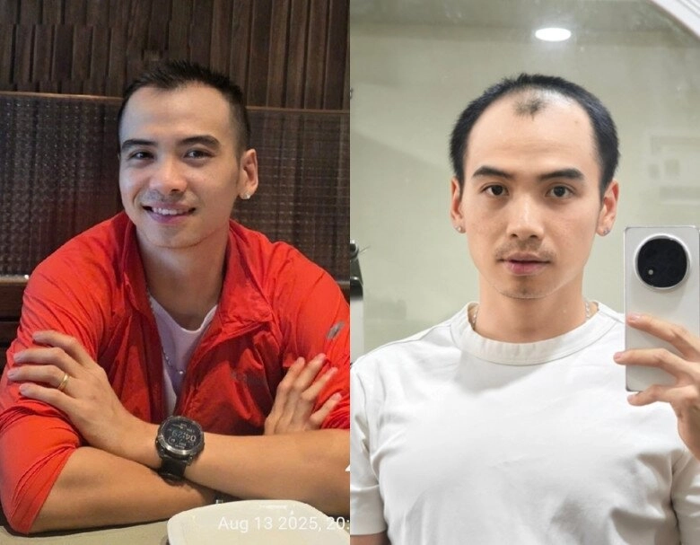 Sao việt 24h hhen niê khoe diện mạo mới của chồng sau khi mọc tóc nam nhiếp ảnh gia đã biết cách giữ gìn nhan sắc - 2