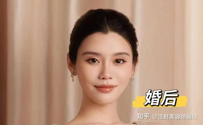 Siêu mẫu nội y được khen hợp làm dâu hào môn cưới chồng thiếu gia xong như lão hóa ngược khác xa quá khứ - 10