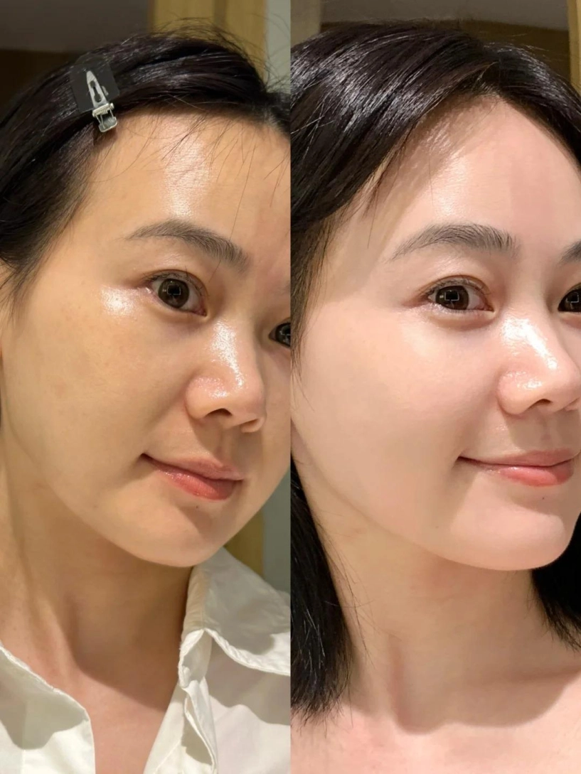 Sự khác biệt giữa cấp ẩm và cấp nước cho làn da làn da của bạn thật sự cần gì - 4