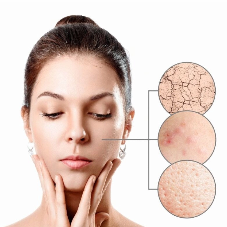 Tại sao ngày càng nhiều phụ nữ chăm sóc da khoa học muốn da tự phục hồi cần phải nắm bí quyết này - 5