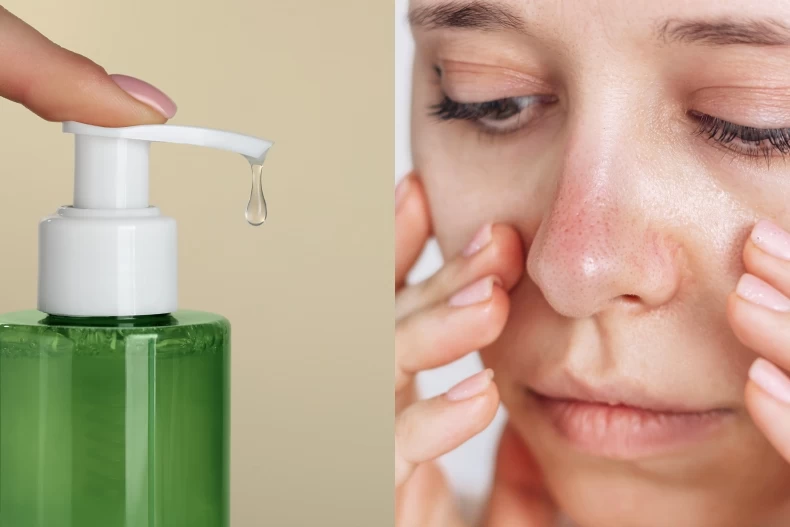 Tại sao nói mụn đầu đen là khắc tinh của tài lộc bác sĩ da liễu chỉ cách dọn sạch bong từng lỗ chân lông - 2