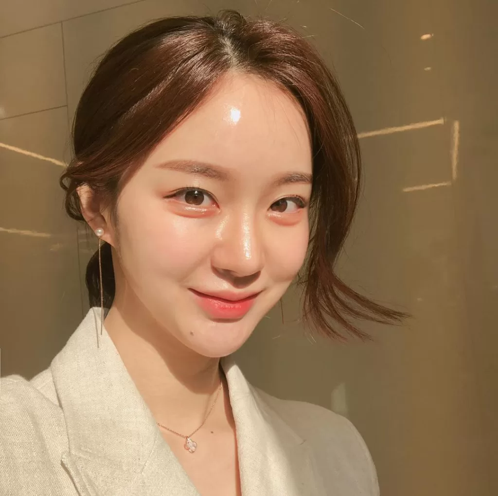 Tại sao tiêm botox phòng ngừa lại dễ khiến bạn dễ trở nên già đi chị em làm đẹp trước tết nên lưu ý - 3
