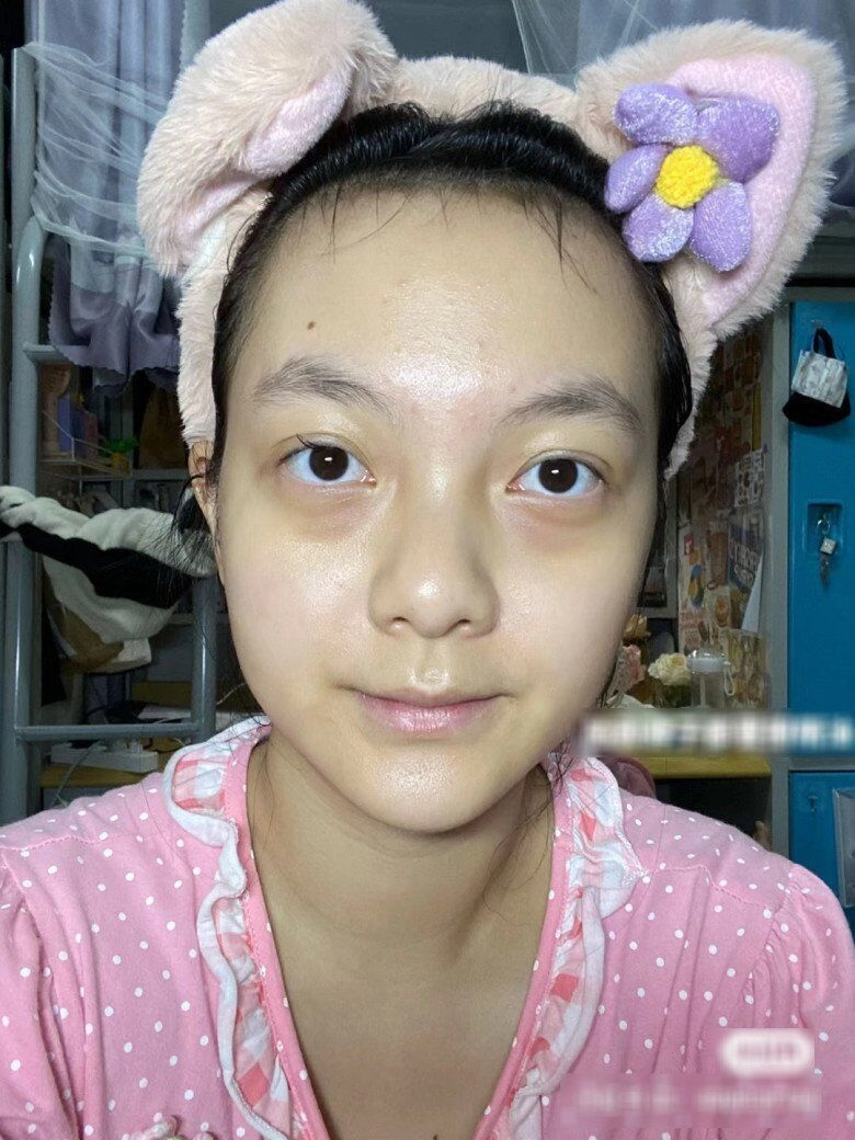 Thử cách chăm sóc da 0 đồng cô gái đẹp lên không tưởng chỉ sau 1 tháng làn da như được tái sinh hoàn toàn - 1