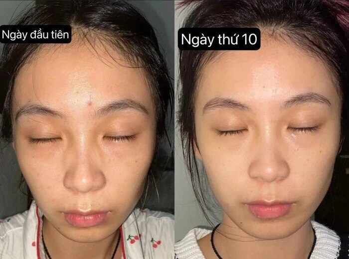Thử cách chăm sóc da 0 đồng cô gái đẹp lên không tưởng chỉ sau 1 tháng làn da như được tái sinh hoàn toàn - 8