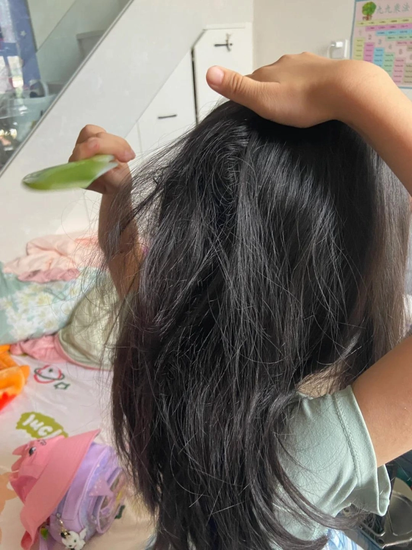 Tóc gãy rụng và gàu rụng từng mảng có lẽ chị em đã quên chăm sóc bộ phận này - 2