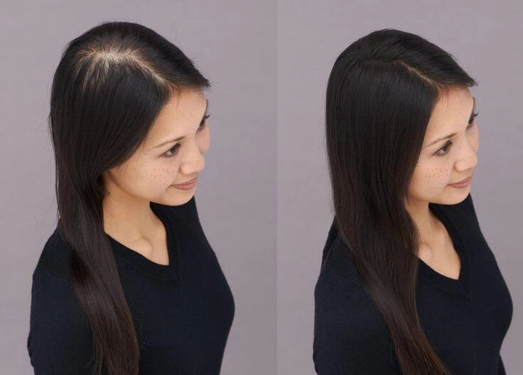 Tóc rụng thưa sắp hói chị em 40 áp dụng 5 phương pháp đơn giản này để đảo ngược tình trạng - 2