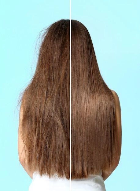 Tóc rụng thưa sắp hói chị em 40 áp dụng 5 phương pháp đơn giản này để đảo ngược tình trạng - 5