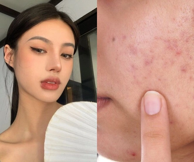 Tránh xa những thói quen ngày tết nếu không muốn da nhăn nheo và cả năm chăm da hoá công cốc - 1