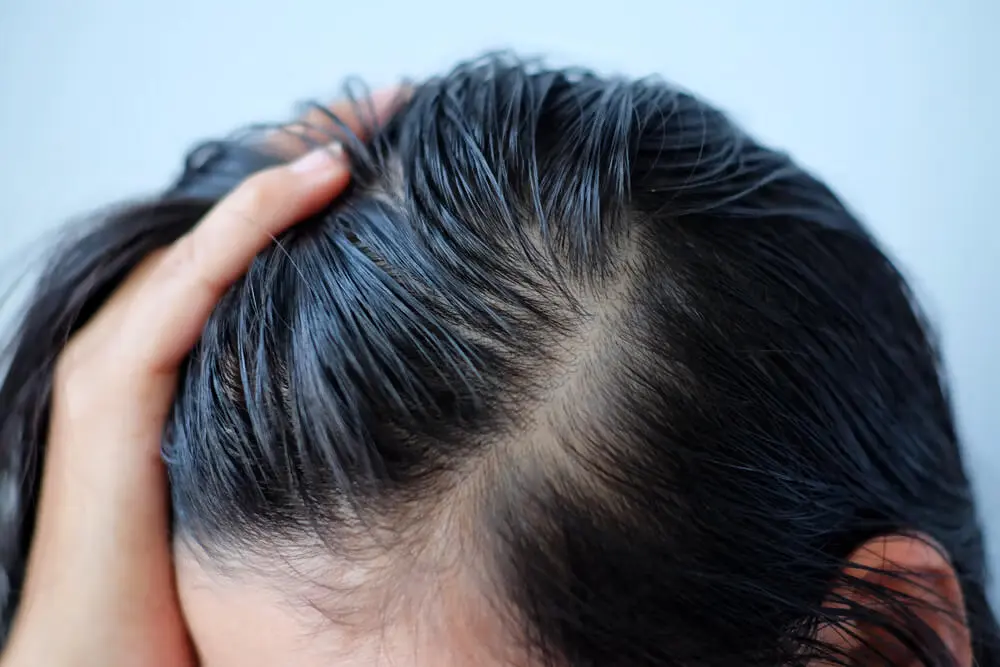 Về quê ăn tết ngày lạnh làm tóc bết dính lưu ngay 3 mẹo xử lý khi không có dầu gội khô tóc liền hoá bồng bềnh - 1