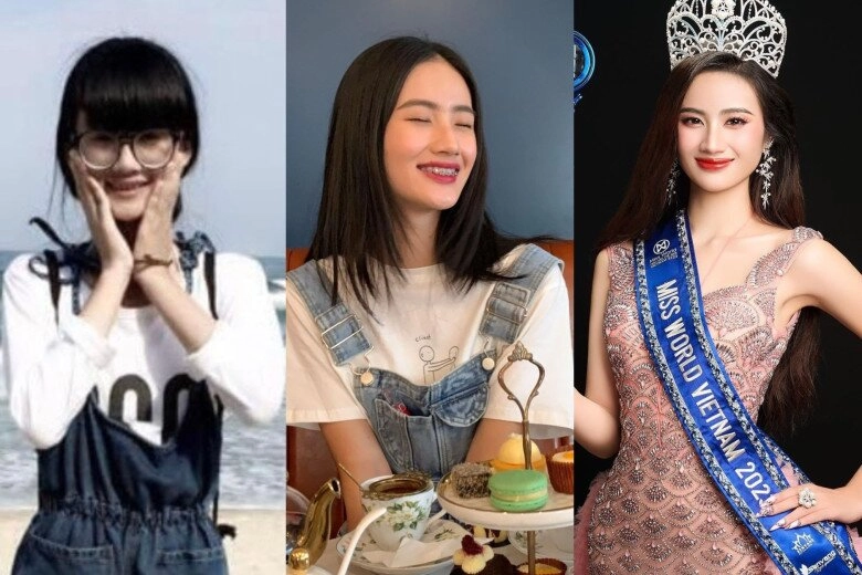3 nàng hậu 10x sau đăng quang dám công khai phẫu thuật thẩm mỹ thanh thủy ý nhi đã đẹp vẫn sửa - 1