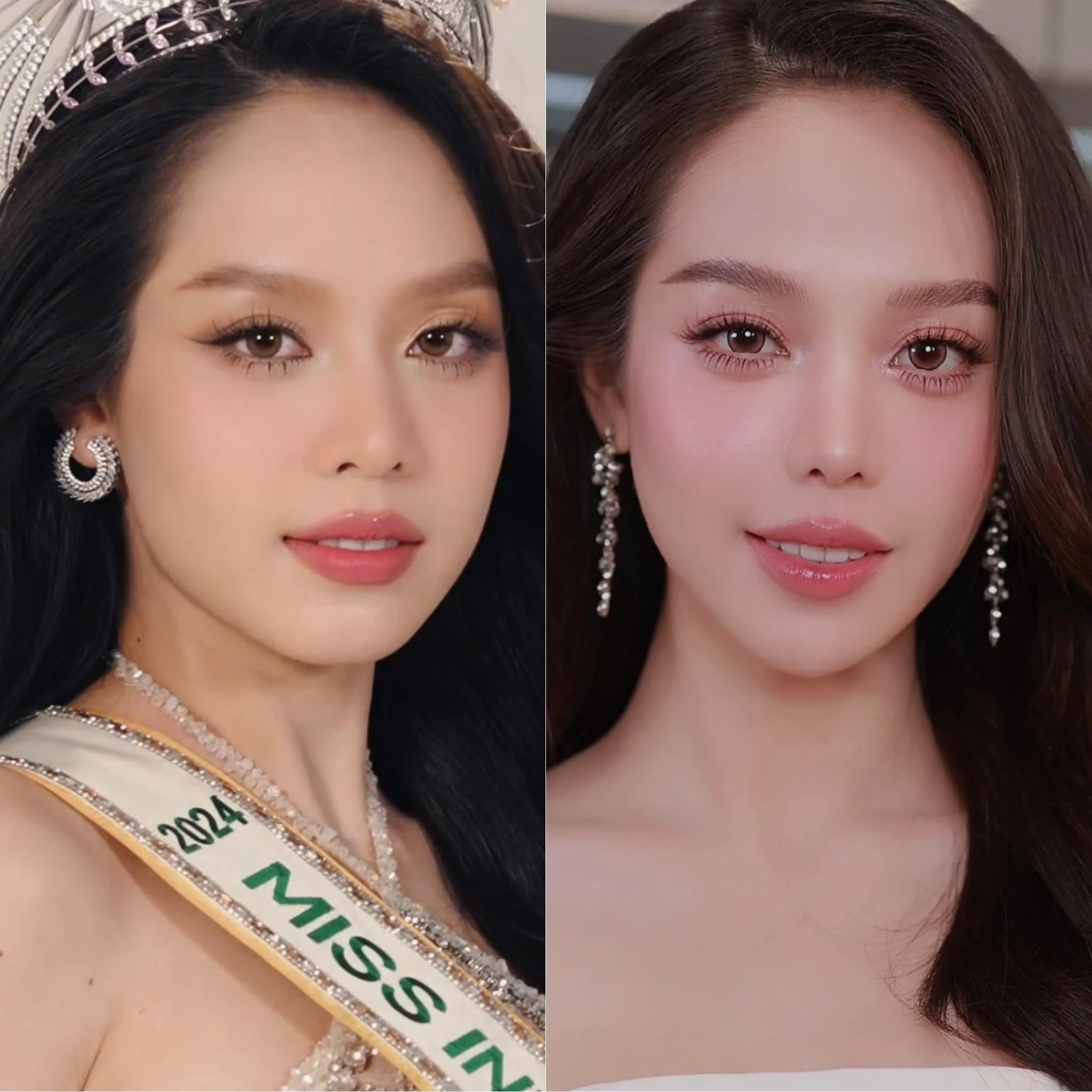3 nàng hậu 10x sau đăng quang dám công khai phẫu thuật thẩm mỹ thanh thủy ý nhi đã đẹp vẫn sửa - 4