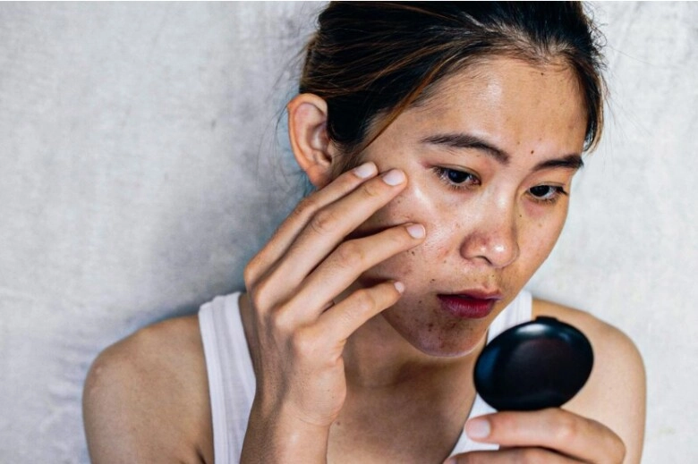 6 thói quen ăn uống khiến da trắng sáng hóa xỉn màu vàng vọt nhiều món chị em rất đam mê - 1