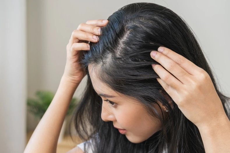 90 chị em đều hiểu sai điều này khi gội đầu bảo sao tóc ngày càng ngứa - 3
