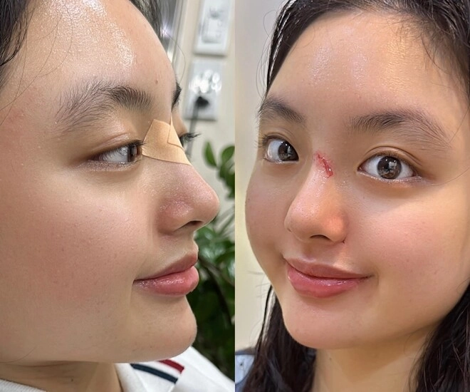 Ái nữ nhà thúy hạnh là bản sao của mẹ sở hữu chiếc mũi cực phẩm bị nghi dao kéo ở tuổi 16 - 1
