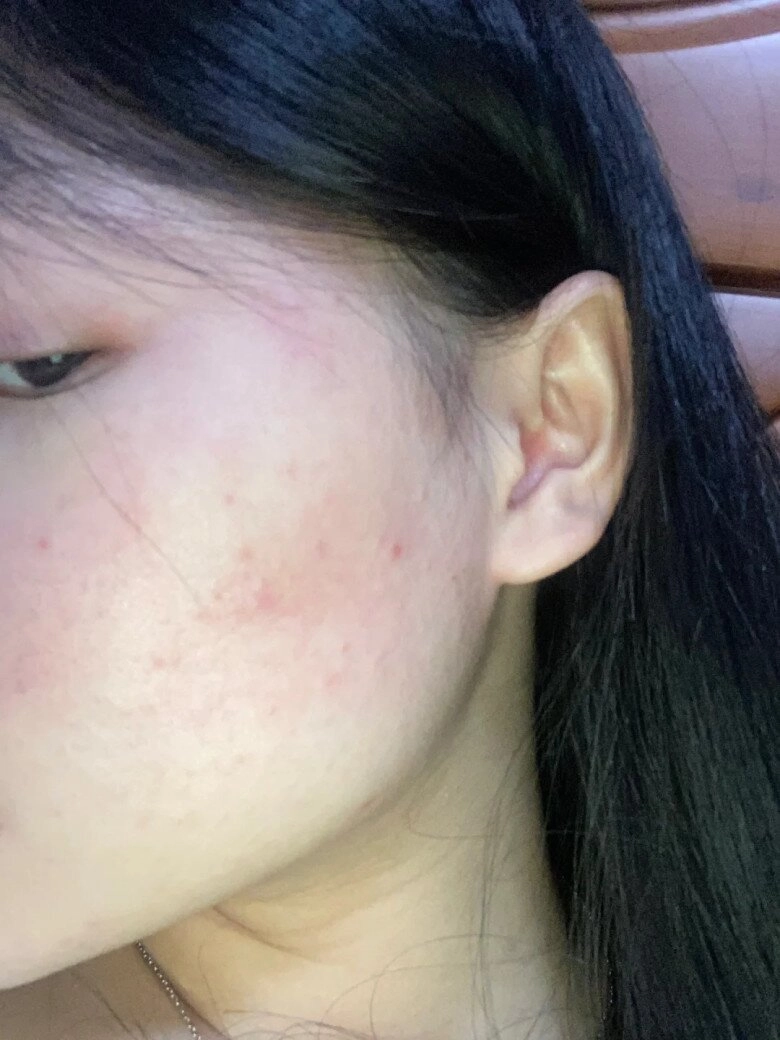 Bạn có chắc kem chống nắng mình đang dùng vẫn an toàn - 3