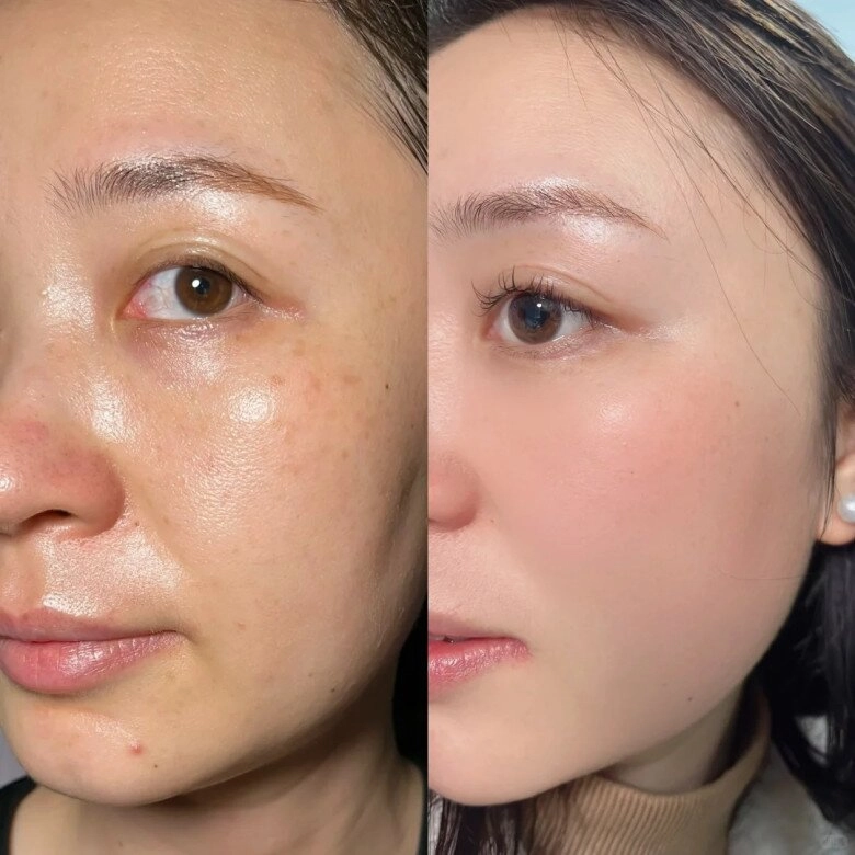 Chuyên gia chỉ ra một loại thần dược 0 đồng giúp tỉnh táo đẹp da hơn uống cà phê mỗi buổi sáng - 4