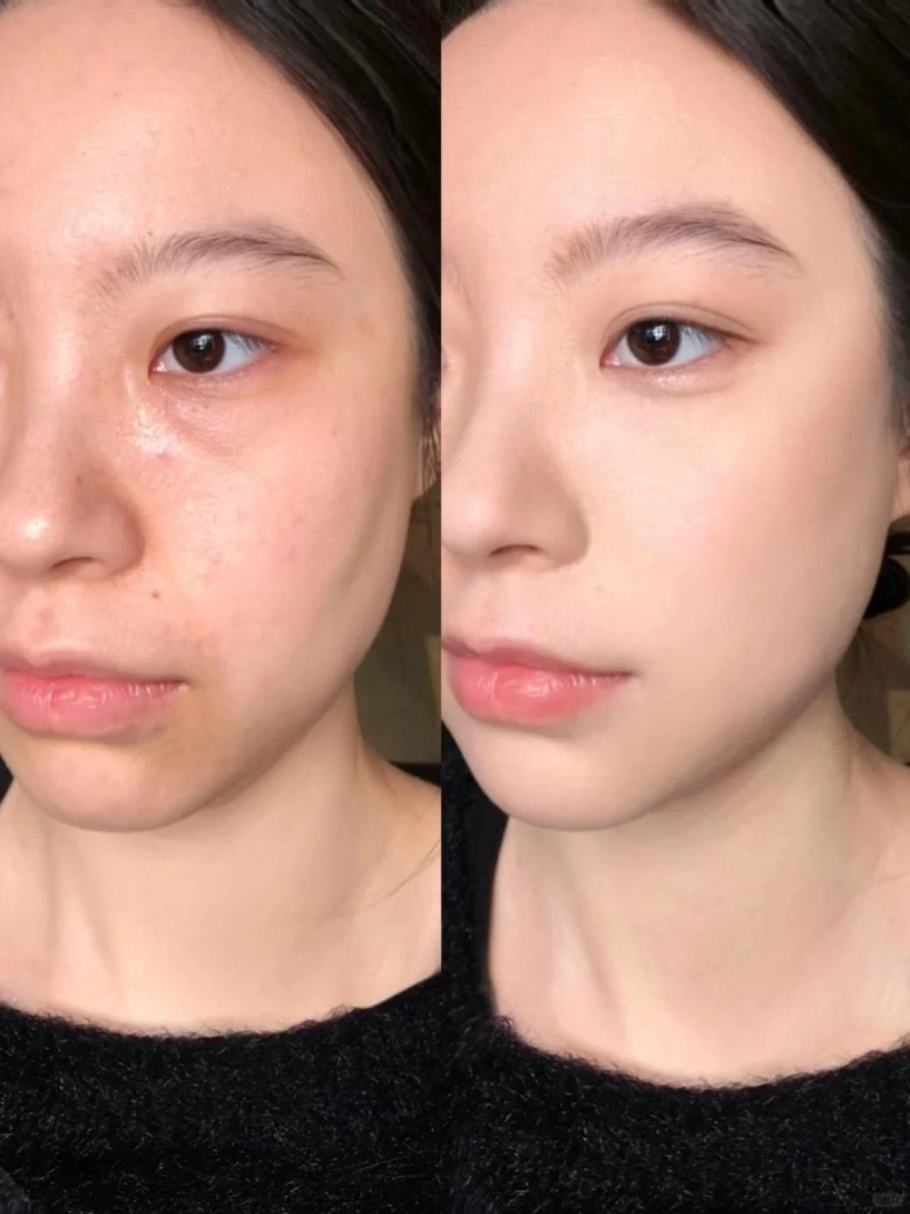 Chuyên gia mách cách trang điểm khiến lỗ chân lông như se khít nhúng mặt vào tô nước đá thoa nước hoa hồng - 2