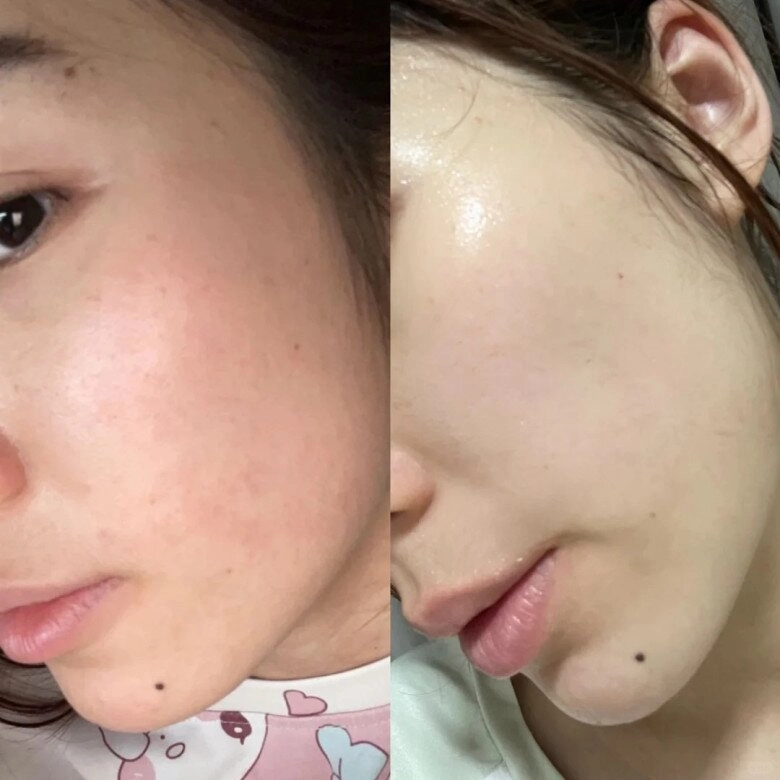 Có nên tẩy tế bào chết trước khi dưỡng trắng da đón tết không chị em nào cũng hoang mang khi biết đáp án - 5