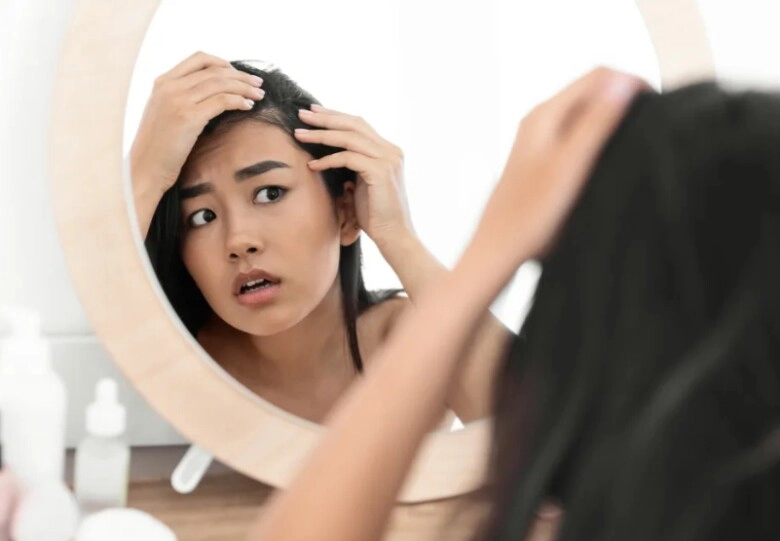 Da đầu lão hóa nhanh gấp 6 lần so với khuôn mặt chuyên gia chỉ ra 2 bước kiểm tra da đầu già hay chưa - 1