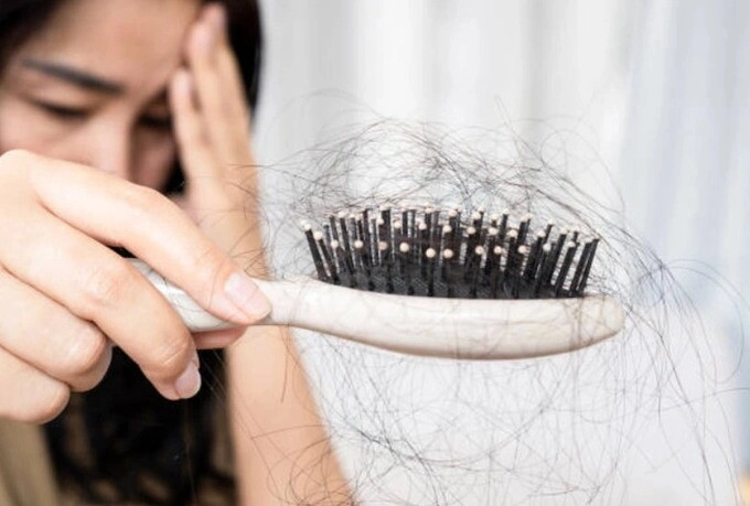 Đừng để tóc rụng không phanh vì lười gội đầu 5 dấu hiệu mái tóc đang gào thét vì gội quá ít - 4