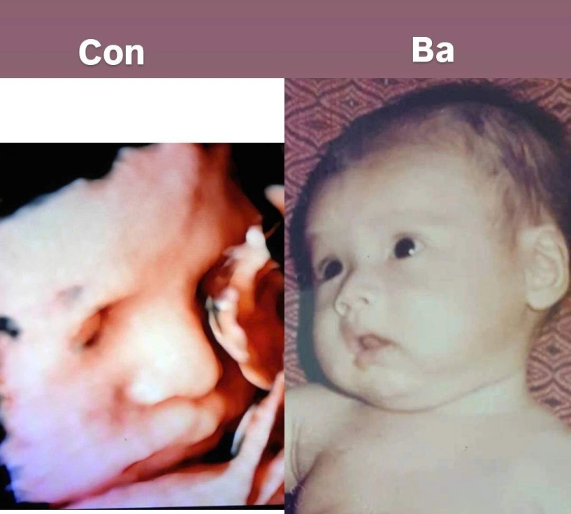 Hhen niê sung sướng được chồng xoa bóp chân không ngại khoe rõ đường chỉ đen trên bụng bầu 9 tháng - 7
