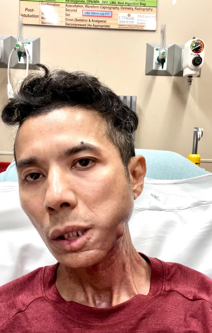 Kasim hoàng vũ nhập viện cấp cứu vì đau đớn không chịu nổi hình ảnh tiều tụy nằm trên giường bệnh gây xót xa - 5