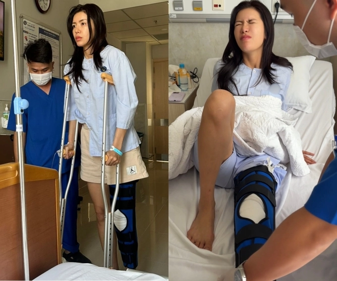 Minh tú chồng trắng đêm chăm tôi bị đứt dây chằng - 1