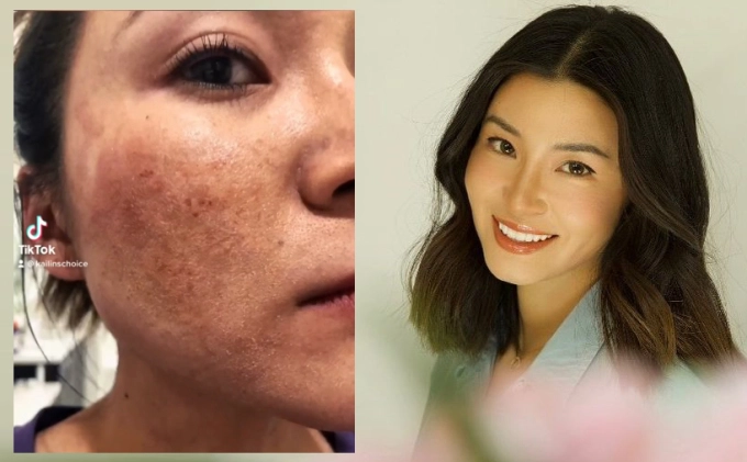 Món sinh tố giúp chuyên gia dinh dưỡng có làn da căng bóng - 3