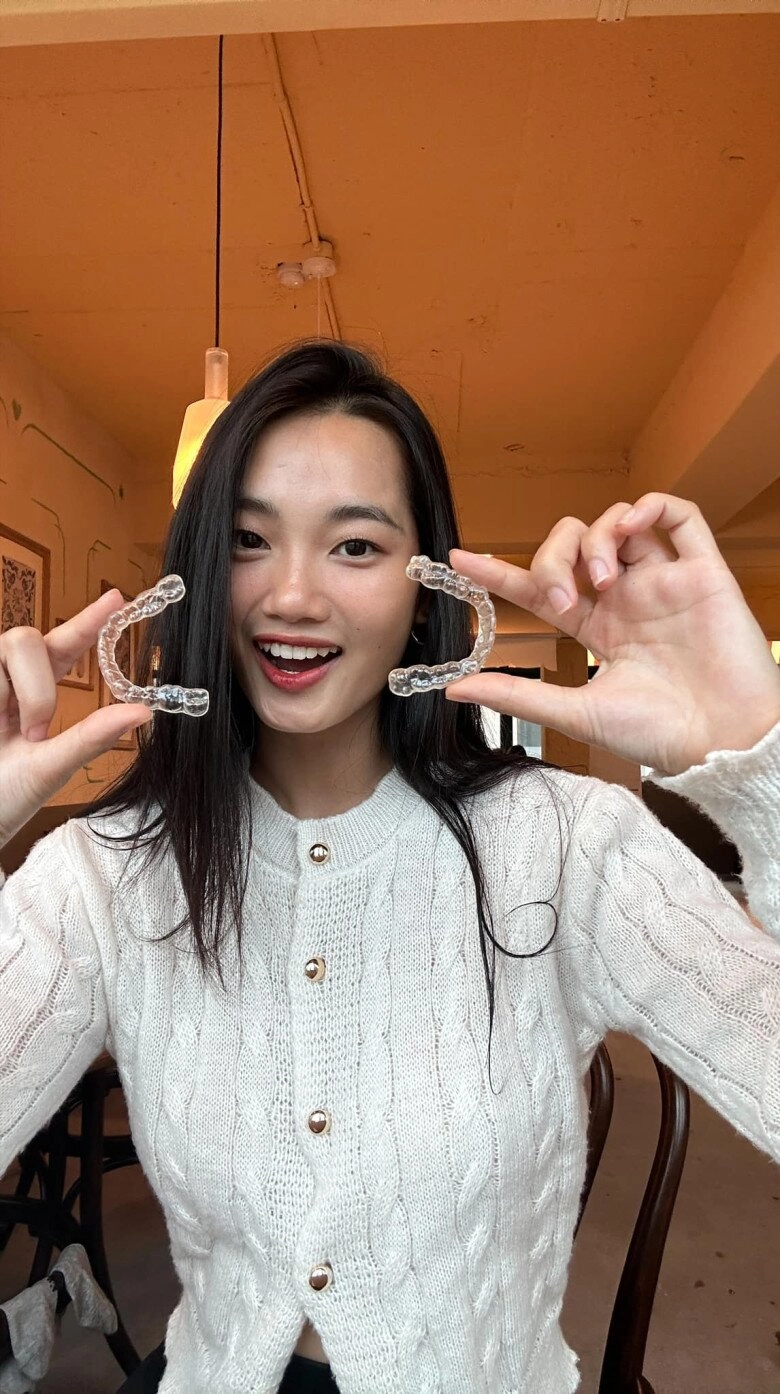 Nhan sắc mộc mạc của 2 á hậu miss universe 2024 người là siêu mẫu châu á người có gương mặt đẹp nhất cuộc thi - 5