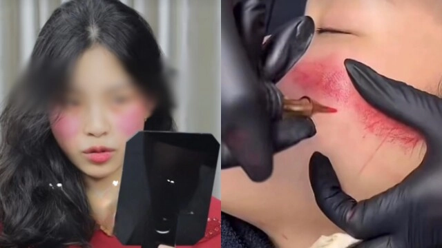 Những trào lưu thẩm mỹ kỳ lạ của giới trẻ ngay cả bác sĩ dao kéo cũng phải hốt hoảng - 1