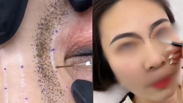 Những trào lưu thẩm mỹ kỳ lạ của giới trẻ ngay cả bác sĩ dao kéo cũng phải hốt hoảng - 4