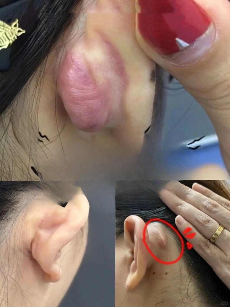 Những trào lưu thẩm mỹ kỳ lạ của giới trẻ ngay cả bác sĩ dao kéo cũng phải hốt hoảng - 7