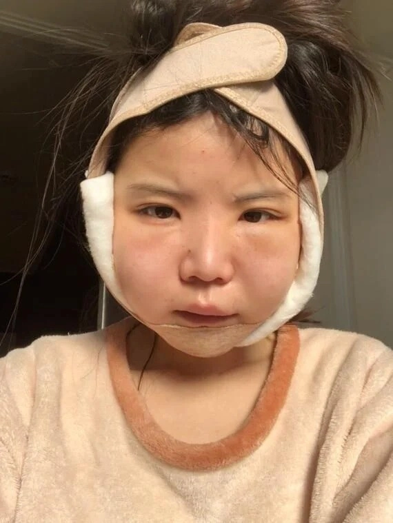 Những trào lưu thẩm mỹ kỳ lạ của giới trẻ ngay cả bác sĩ dao kéo cũng phải hốt hoảng - 9