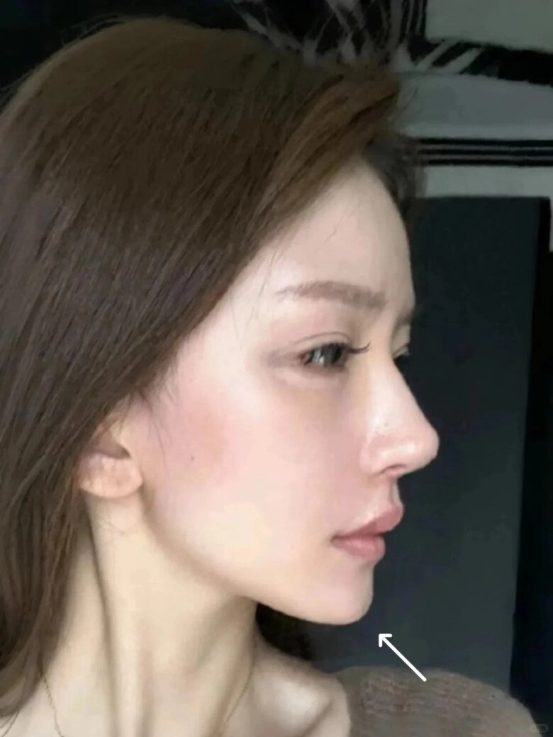 Những trào lưu thẩm mỹ kỳ lạ của giới trẻ ngay cả bác sĩ dao kéo cũng phải hốt hoảng - 10