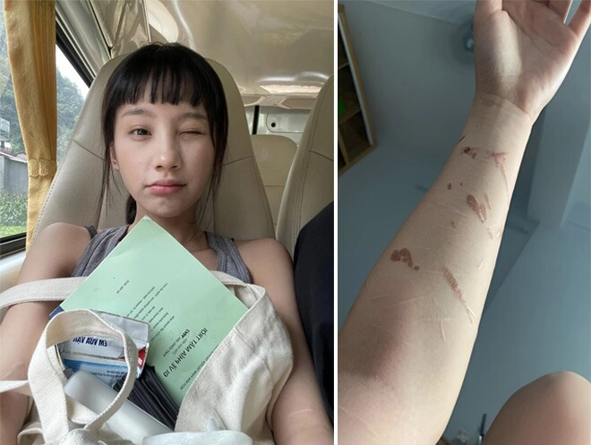 Nữ chính đi giữa trời rực rỡ lộ chi tiết bất thường trên tay vì sao khán giả lại nhớ tới hương tràm - 3