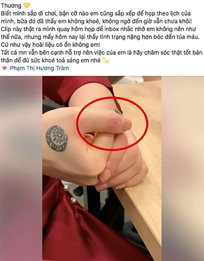 Nữ chính đi giữa trời rực rỡ lộ chi tiết bất thường trên tay vì sao khán giả lại nhớ tới hương tràm - 8