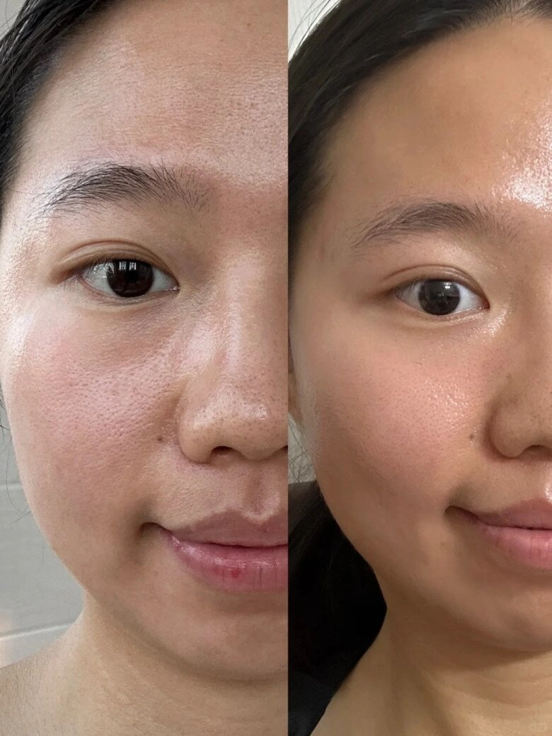 Phương pháp chăm sóc da 3 bước giúp làn da sáng mềm mịn như sữa được phái đẹp bên trung truyền tai nhau - 2