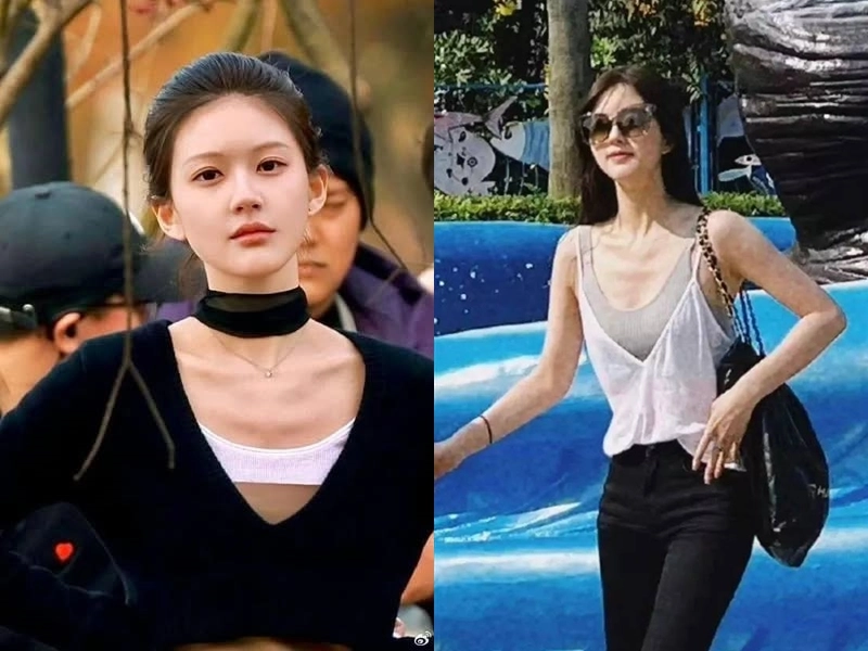 Sao cbiz kiệt sức vì quay phim triệu lộ tư gầy trơ xương không thể đi lại triệu lệ dĩnh lệch xương sống - 2