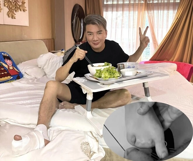 Sao việt 24h đàm vĩnh hưng lên tiếng về bức ảnh bàn chân chỉ còn 1 ngón khẳng định không còn gì để mất - 1