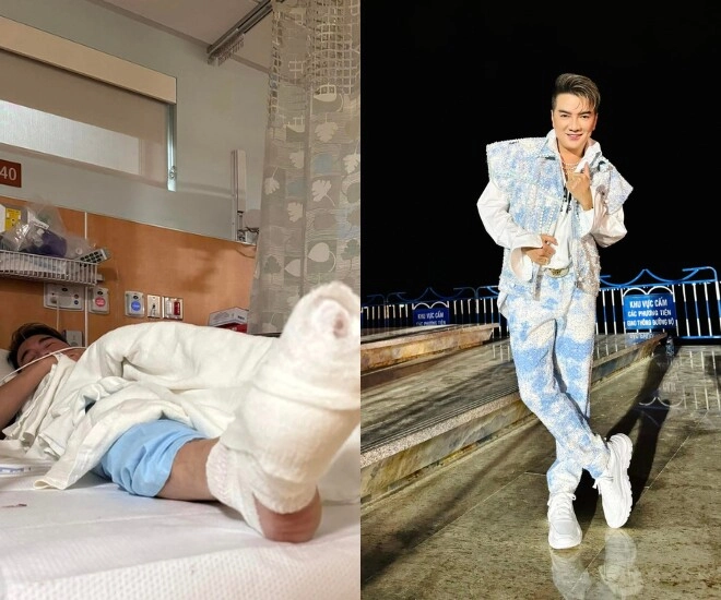 Sao việt gặp nạn để lại thương tật đàm vĩnh hưng mất nhiều ngón chân có người phải cắt 1 tay - 1