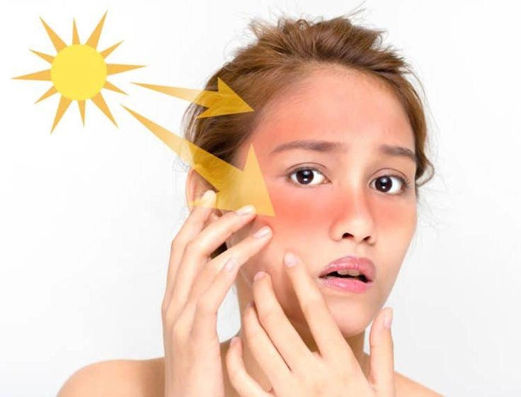 Tại sao kem chống nắng là phần quan trọng nhất trong chu trình chăm sóc da - 2