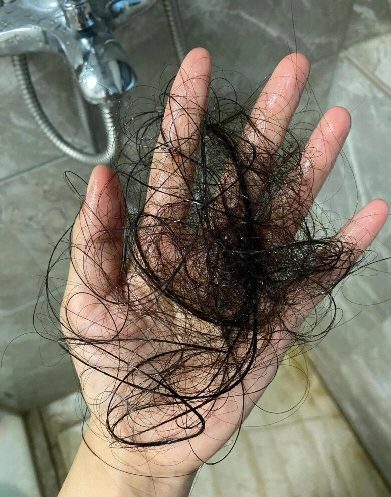 Tại sao lau dọn mỗi ngày nhưng nhà vẫn đầy lông bụi học cách này nhà bạn sẽ sạch bong kin kít - 3