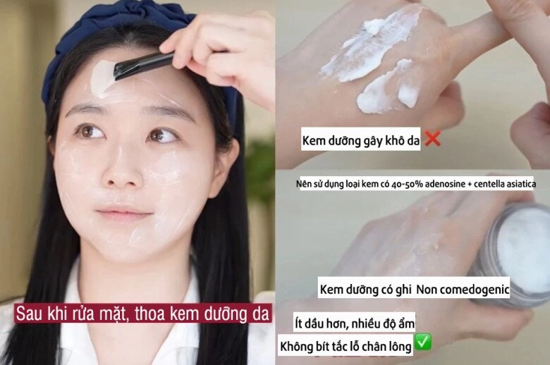 Thoa kem dưỡng ẩm mùa đông bác sĩ da liễu bật mí nên dùng thêm giấy thấm dầu vì sao - 2