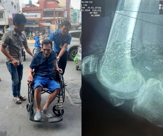 Thông tin mới nhất về tình hình sức khỏe của thương tín 1 chân không thể hồi phục chưa thể phẫu thuật vì rất yếu - 1