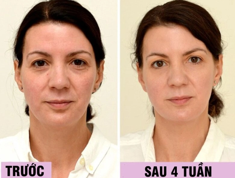 Uống loại nước rẻ tiền này mỗi ngày người phụ nữ u45 đẹp lên không tưởng chỉ sau 1 tháng làn da như được tái sinh hoàn toàn - 1