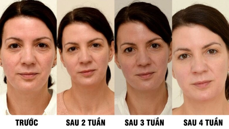 Uống loại nước rẻ tiền này mỗi ngày người phụ nữ u45 đẹp lên không tưởng chỉ sau 1 tháng làn da như được tái sinh hoàn toàn - 2