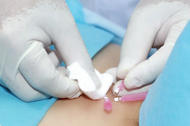 Xoa bóp hay cấy chỉ đâu là lựa chọn giảm cân tốt hơn trong mùa đông - 5